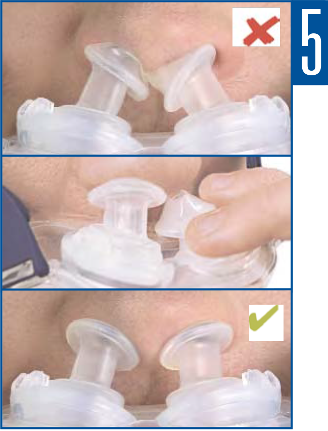 Como ajustar a máscara facial Mirage Liberty ResMed Como ajustar a máscara facial Mirage Liberty ResMed