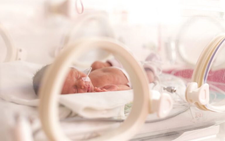 Apneia da prematuridade: o que é, causas e tratamento para recém-nascidos | CPAPS